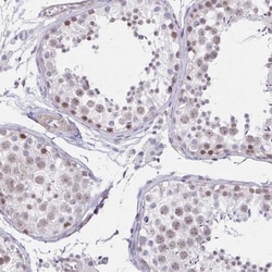 ANKRD62 Antibody, Novus Biologicals:Antibodies:Primary Antibodies